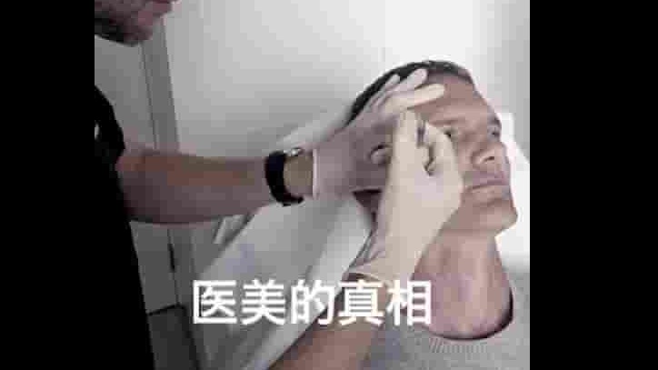 BBC纪录片《医美的真相 The Truth About Cosmetic Treatments 2020》全2集 英语中字 1080p高清网盘下载