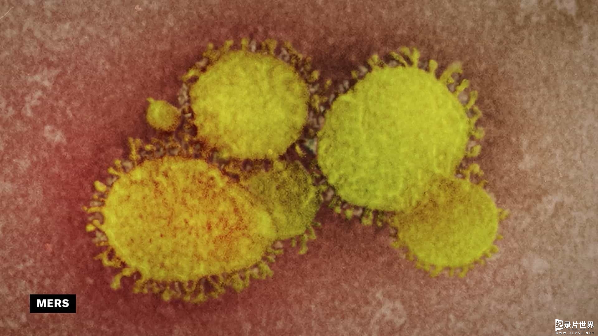 Netflix纪录片/病毒纪录片《新冠病毒解码 Coronavirus, Explained 2020》全3集