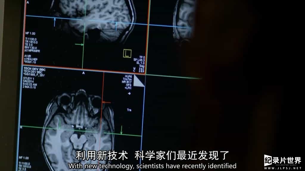 BBC纪录片《地平线 你的大脑是男性还是女性/男女脑不同 Horizon - Is your brain male or female?》全1集