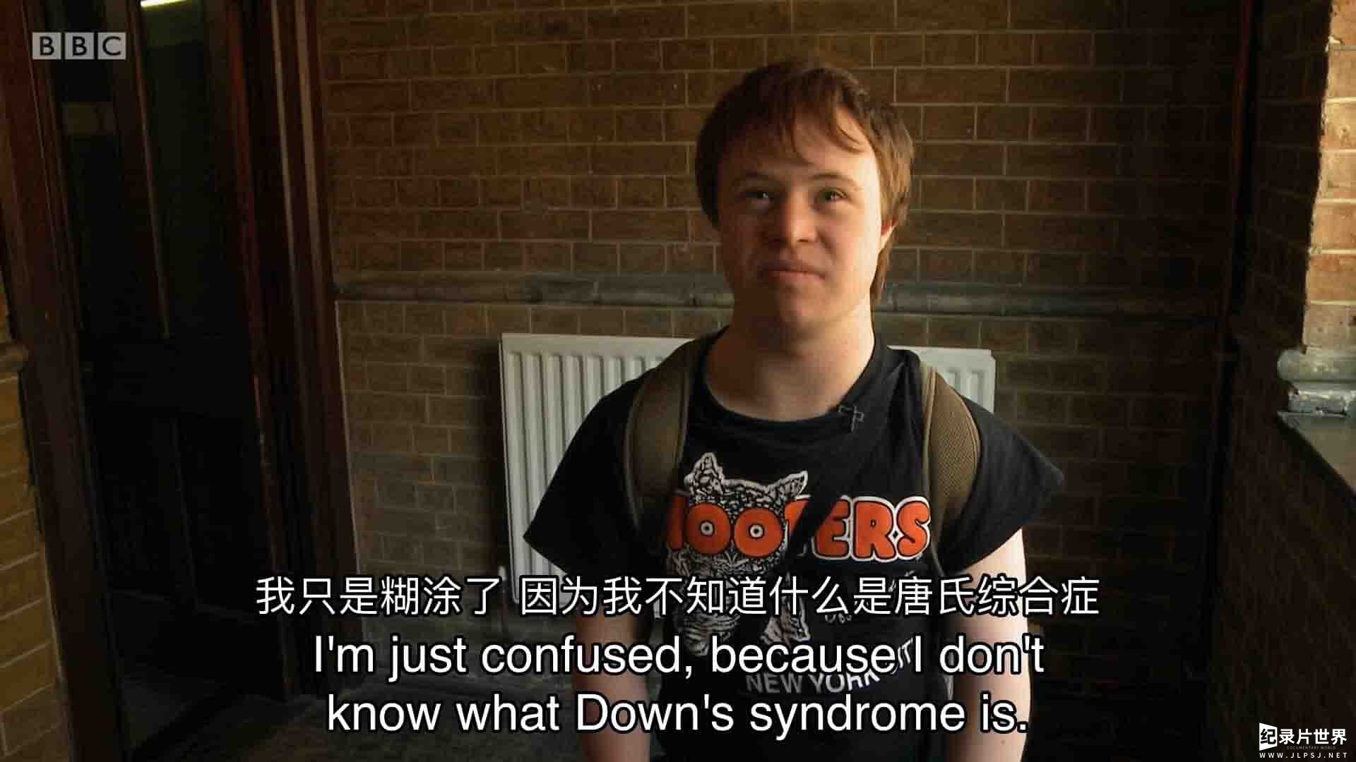 BBC纪录片《成长中的唐氏综合症 Growing Up Down's 2014》全1季