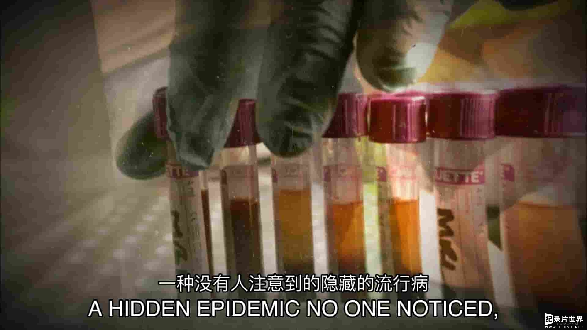 史密森尼频道《致命病毒的崛起 The Rise of the Killer Virus 2014》全1集