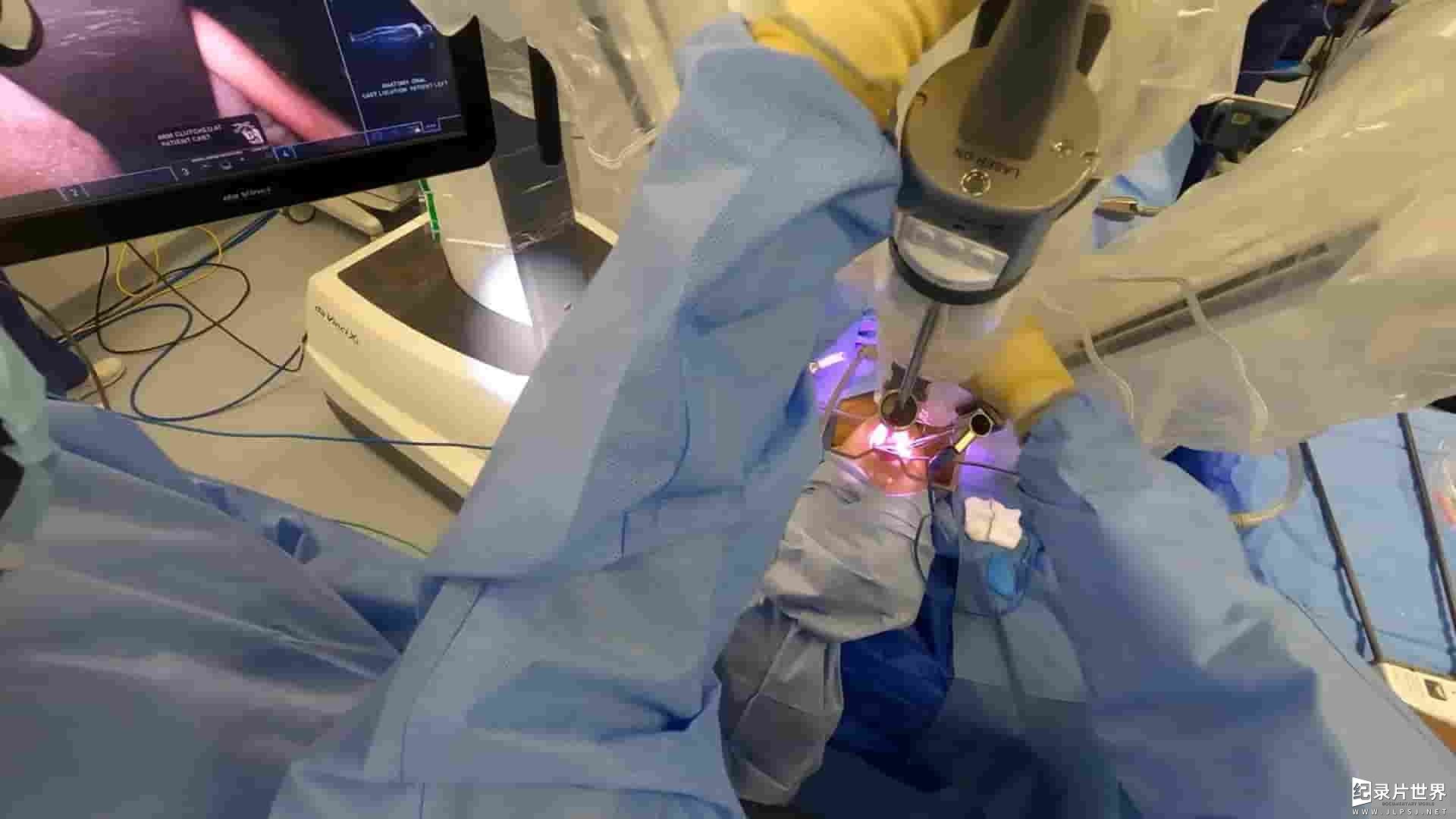 BBC纪录片《超级外科医生：生命的机会 Super Surgeons: A Chance at Life 2022》全3集